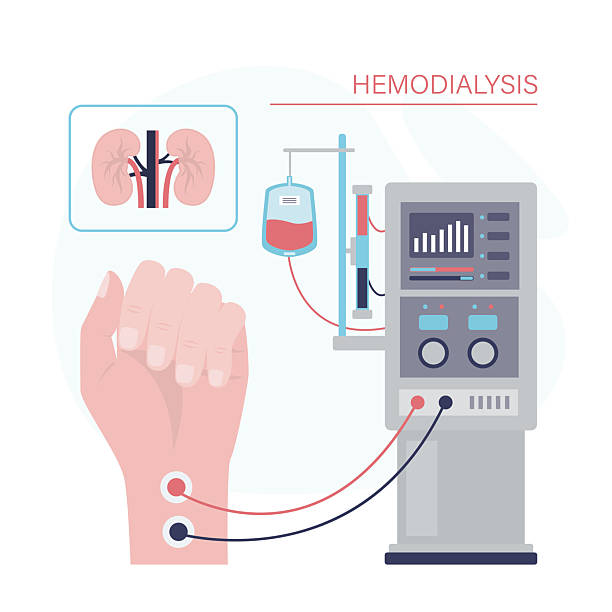 Hemodialysis machine equipment